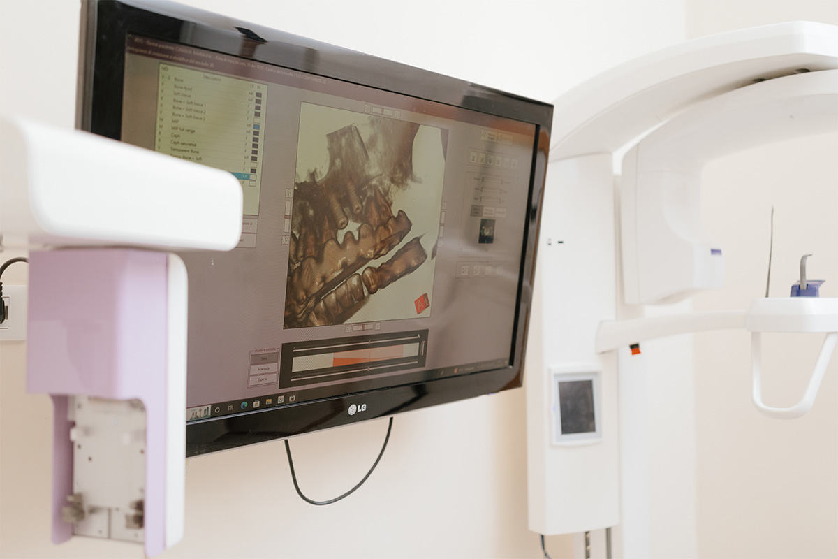 studio-dentistico-ancona-akhyari-urgenze odontoiatriche studio 127
